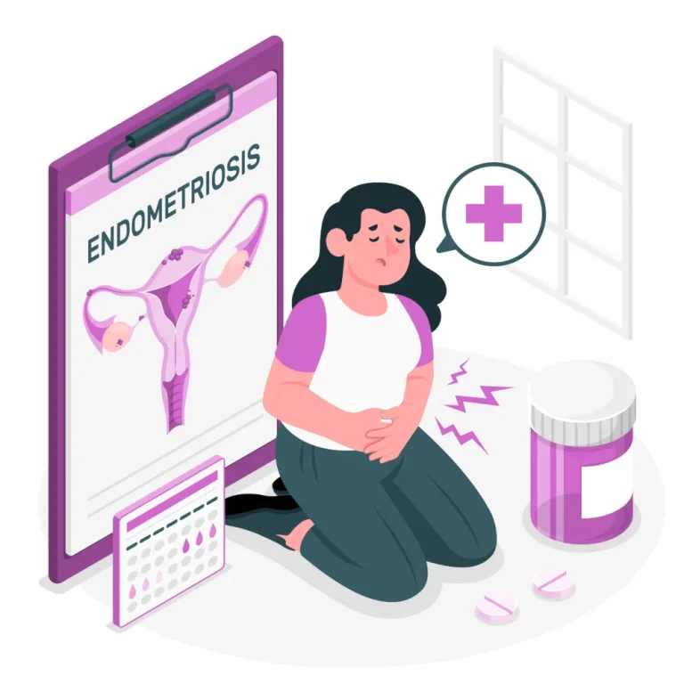 Endometrioza